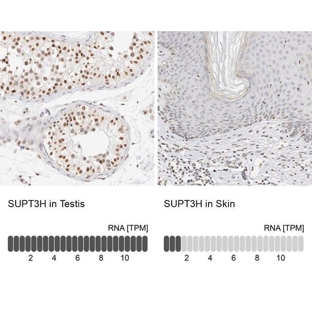 Anti-SUPT3H antibody produced in rabbit