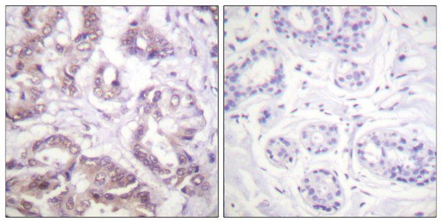 Anti-Survivin antibody produced in rabbit