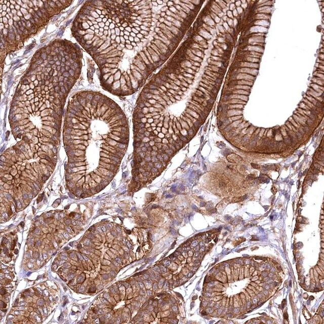 Anti-SVIP antibody produced in rabbit