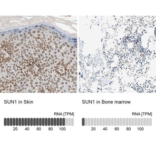 ANTI-SUN1 antibody produced in rabbit