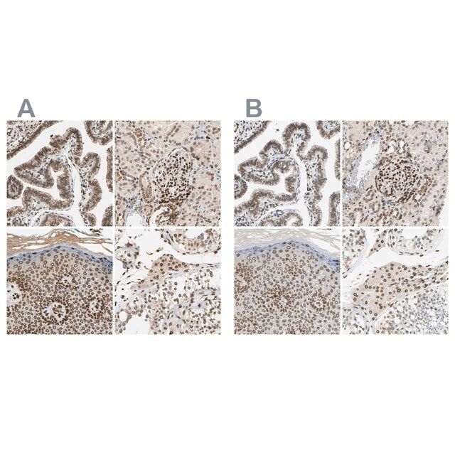 ANTI-SUN1 antibody produced in rabbit