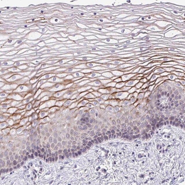 Anti-SUSD4 antibody produced in rabbit