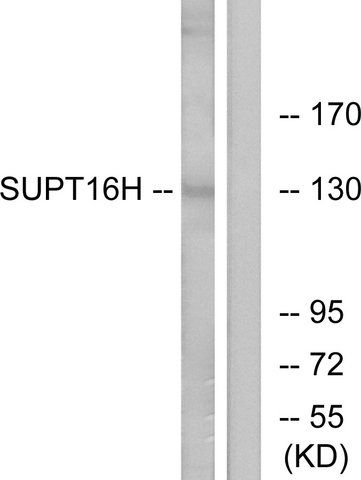 Anti-SUPT16H antibody produced in rabbit