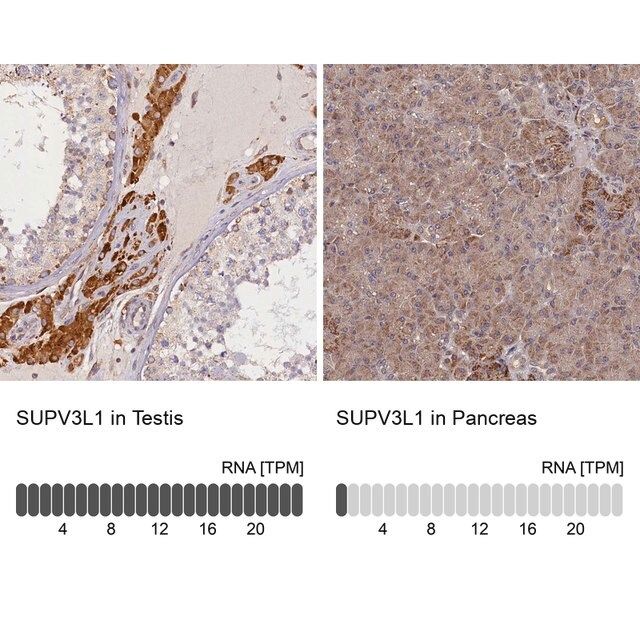 Anti-SUPV3L1 antibody produced in rabbit