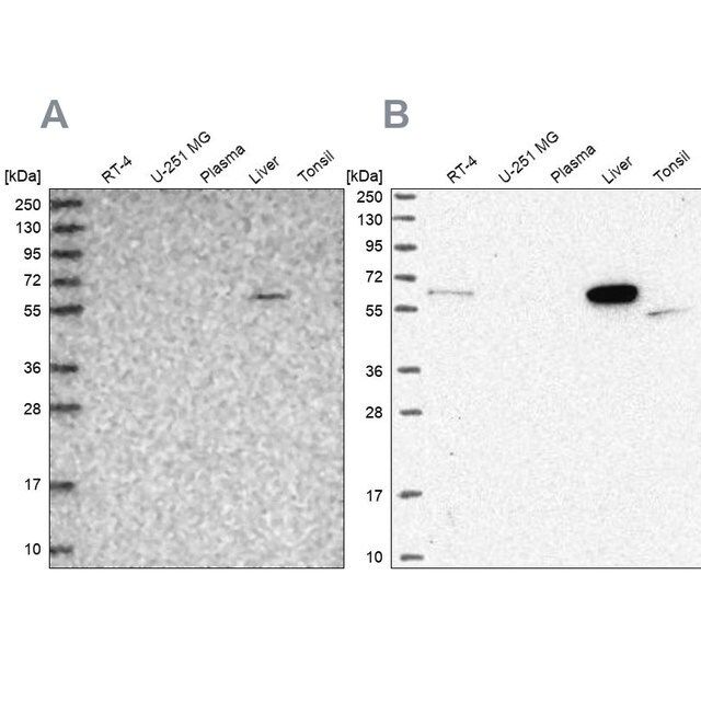 Anti-SUOX antibody produced in rabbit