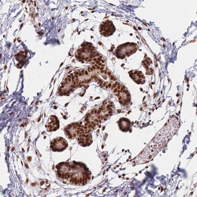 Anti-SUPT6H antibody produced in rabbit