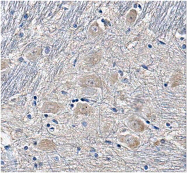 Anti-SUR1 Antibody, clone N289/16