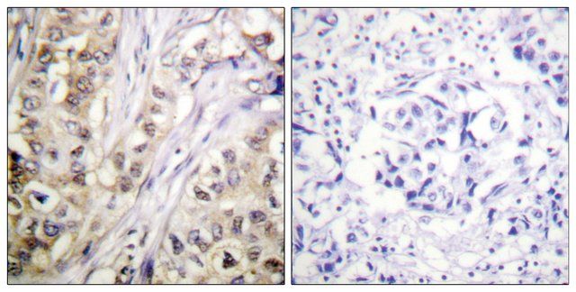 Anti-Survivin antibody produced in rabbit