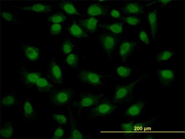 ANTI-SURB7 antibody produced in mouse