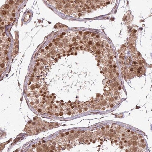 Anti-SWI5 antibody produced in rabbit