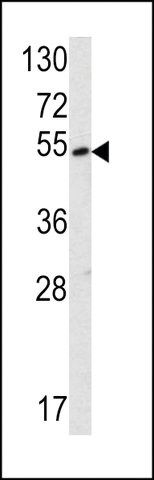 ANTI-SUV4-20H2 (CENTER) antibody produced in rabbit