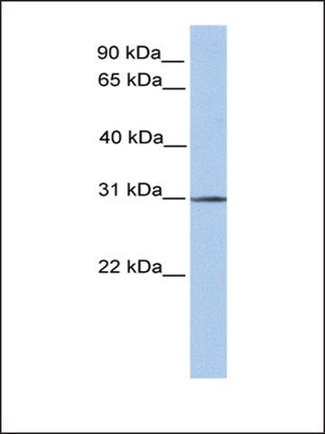 Anti-SURF4 antibody produced in rabbit