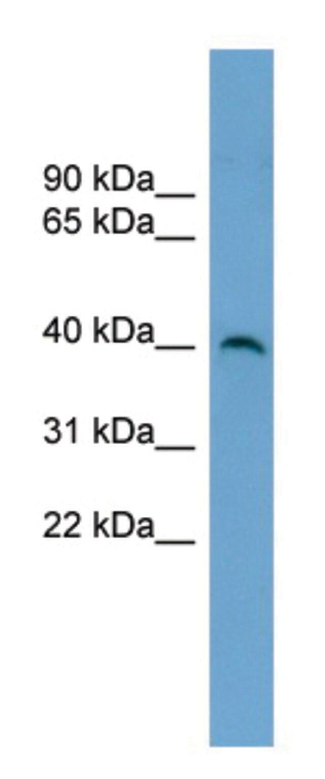 Anti-SUV39H2 antibody produced in rabbit