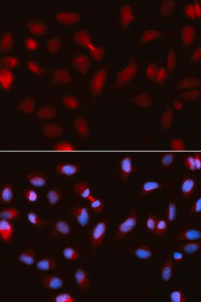 Anti-Survivin antibody produced in rabbit