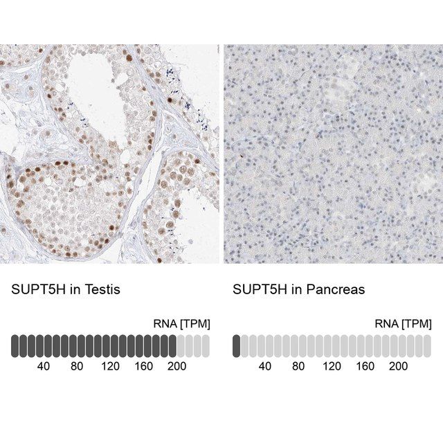 Anti-SUPT5H antibody produced in rabbit