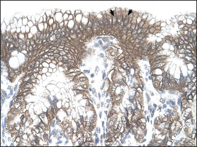 Anti-TARS antibody produced in rabbit