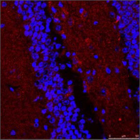 Anti-STUB1, (N-terminal) antibody produced in rabbit