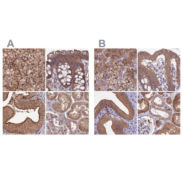 Anti-STUB1 antibody produced in rabbit