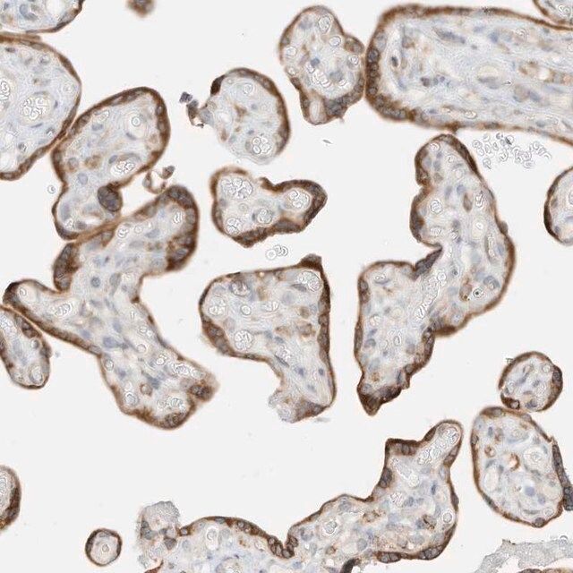 Anti-STT3A antibody produced in rabbit