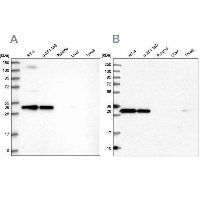 Anti-STX6 antibody produced in rabbit