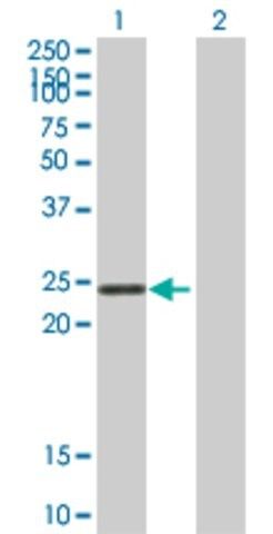 Anti-STYX antibody produced in mouse