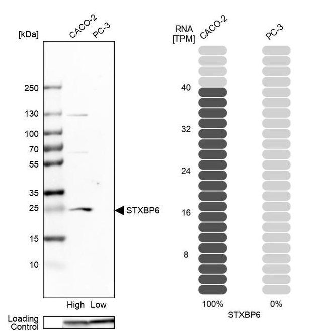 Anti-STXBP6 antibody produced in rabbit