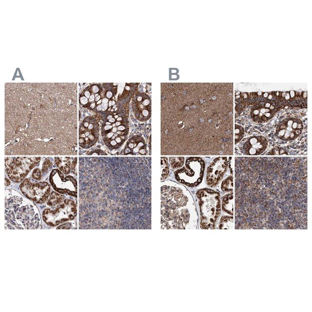 Anti-SUCLA2 antibody produced in rabbit