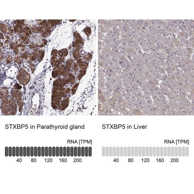 Anti-STXBP5 antibody produced in rabbit