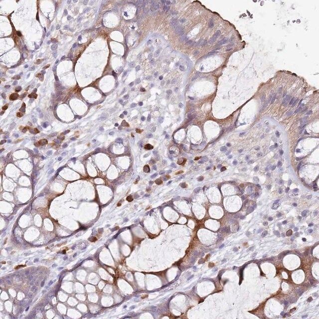 Anti-STYK1 antibody produced in rabbit