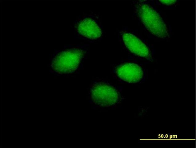 Anti-SUHW1 antibody produced in mouse