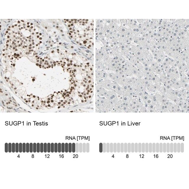 Anti-SUGP1 antibody produced in rabbit