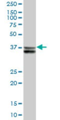 Anti-SUGT1 antibody produced in mouse