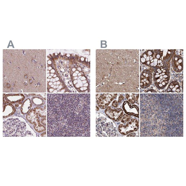 Anti-SUCLA2 antibody produced in rabbit