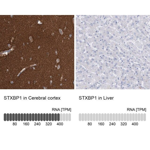 Anti-STXBP1 antibody produced in rabbit