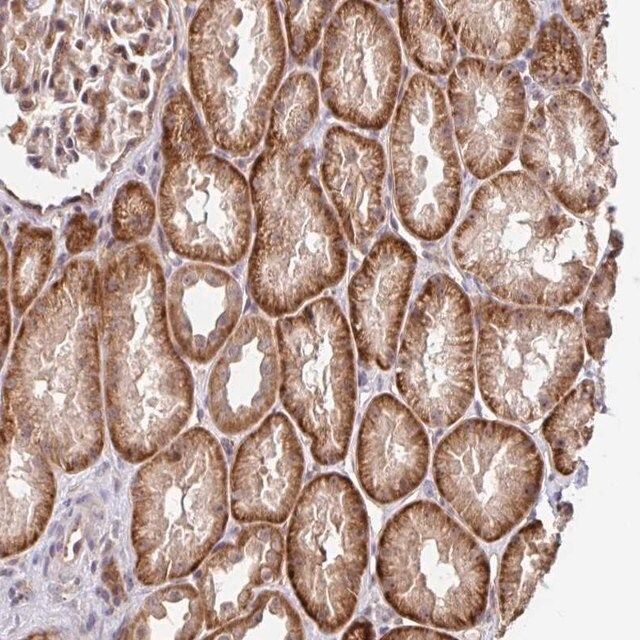 Anti-STYXL1 antibody produced in rabbit