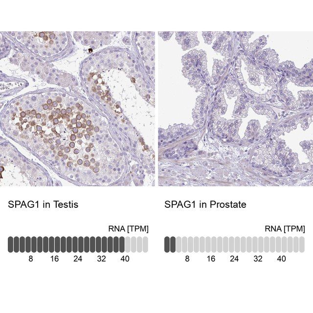 Anti-SPAG1 antibody produced in rabbit