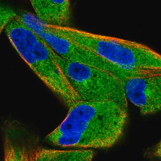 Anti-SPAG9 antibody produced in rabbit