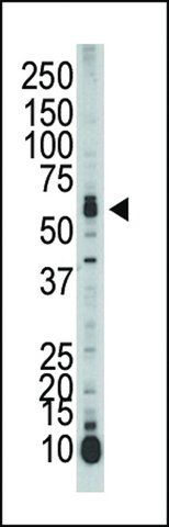 ANTI-SPAK (CENTER) antibody produced in rabbit