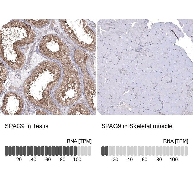 Anti-SPAG9 antibody produced in rabbit