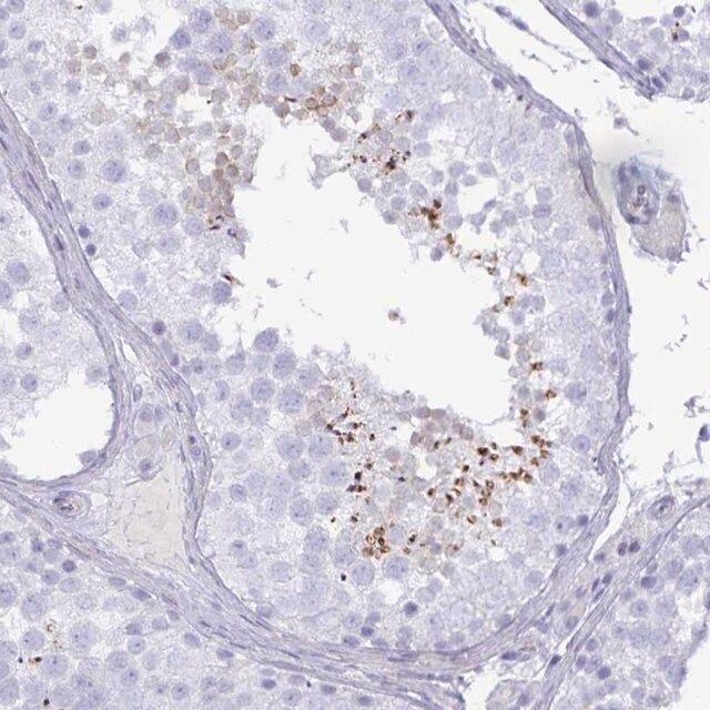 Anti-SPAG4 antibody produced in rabbit