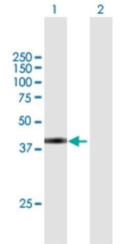 Anti-SPAG4L antibody produced in mouse