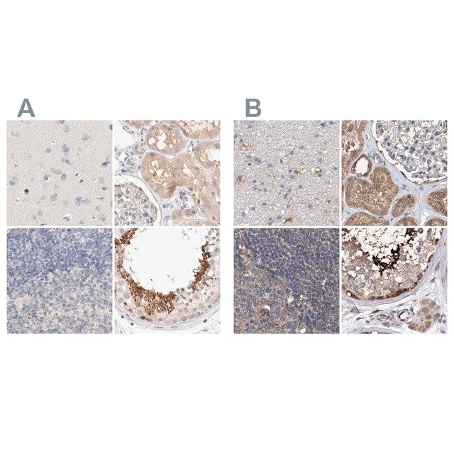 Anti-SPATA20 antibody produced in rabbit