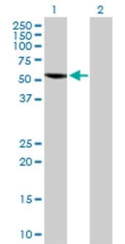 Anti-SPAG6 antibody produced in rabbit