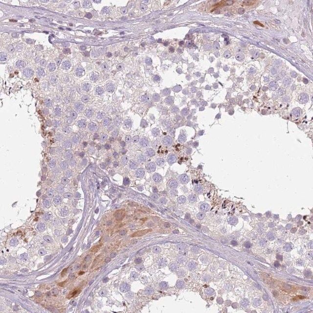 Anti-SPAG4 antibody produced in rabbit