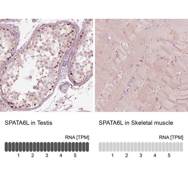 Anti-SPATA6L antibody produced in rabbit