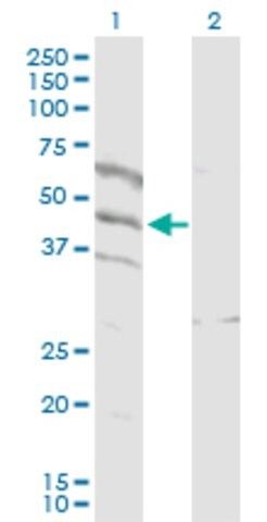 Anti-SPATA5L1 antibody produced in rabbit