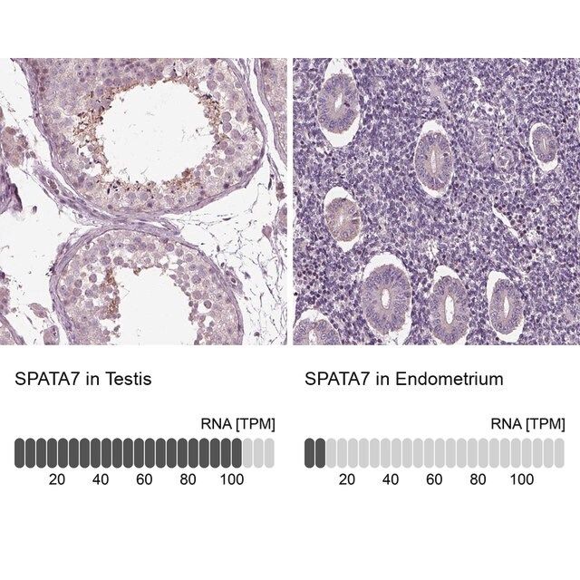 Anti-SPATA7 antibody produced in rabbit