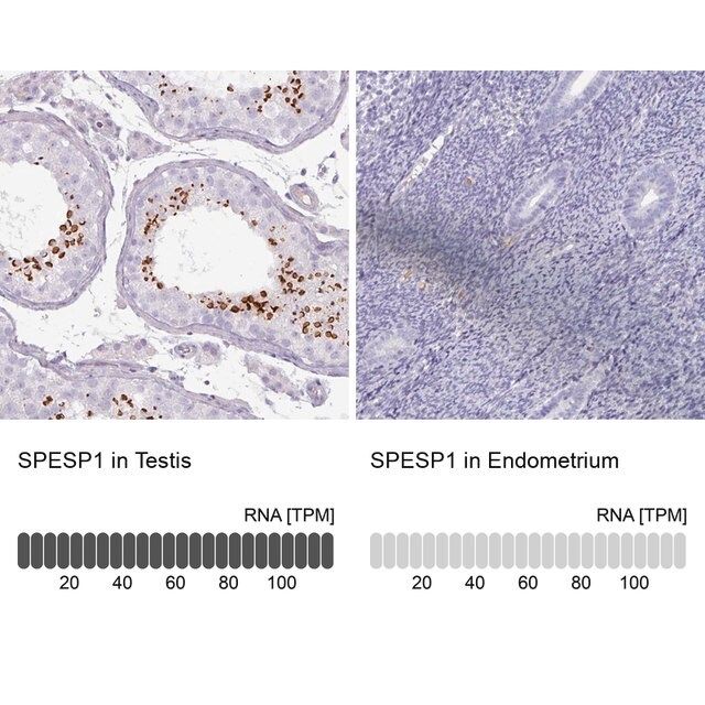 Anti-SPESP1 antibody produced in rabbit