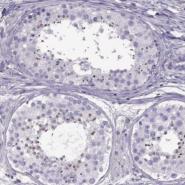 Anti-SPDYE1 antibody produced in rabbit