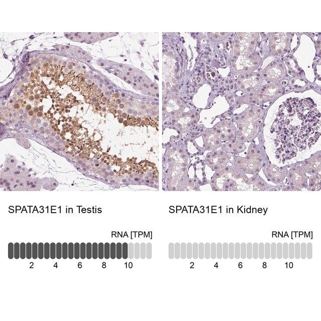 Anti-SPATA31E1 antibody produced in rabbit